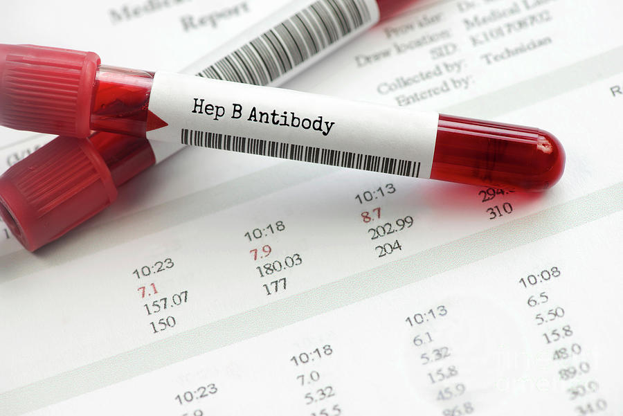 Hepatitis B Antibody Blood Test Photograph by Sherry Yates Young