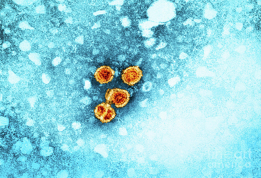 Hepatitis B Virus Particles Photograph By Cdc/niaid/national Institutes ...