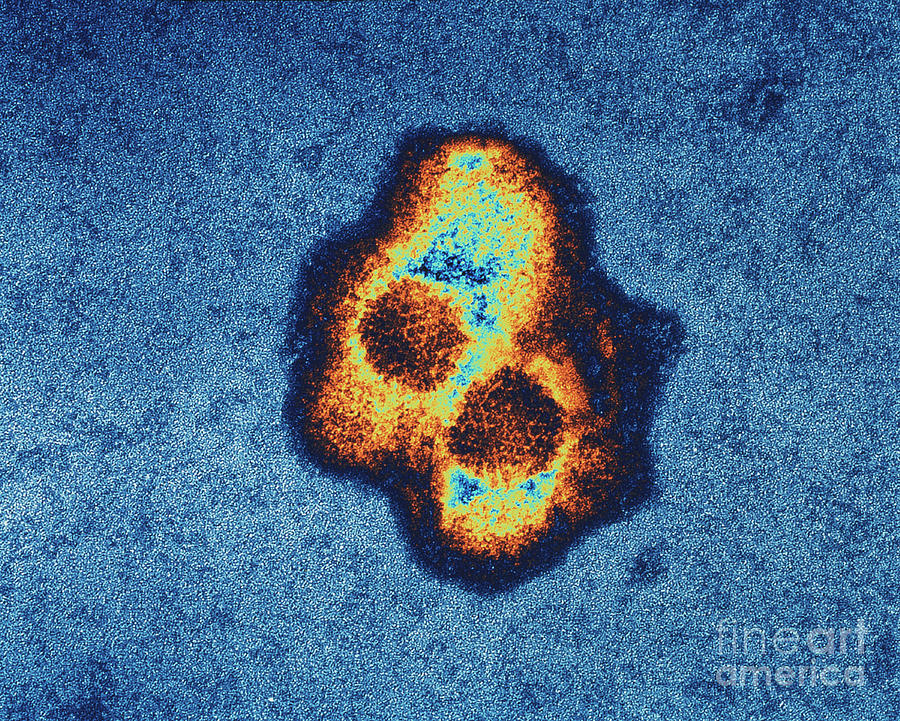 Herpesvirus Photograph by Geoff Tompkinson/science Photo Library