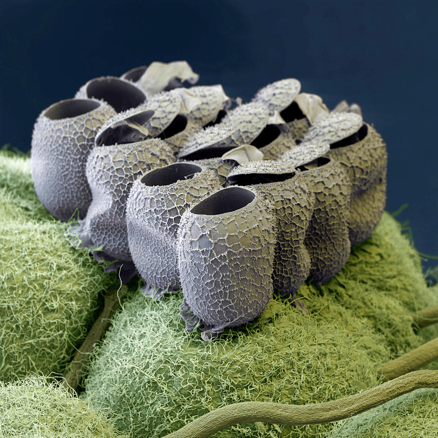 Heteroptera Egg Nest, Sem Photograph by Oliver Meckes EYE OF SCIENCE