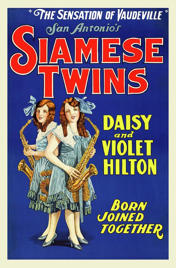 Hilton Sisters - Siamese Twins Painting by Unknown