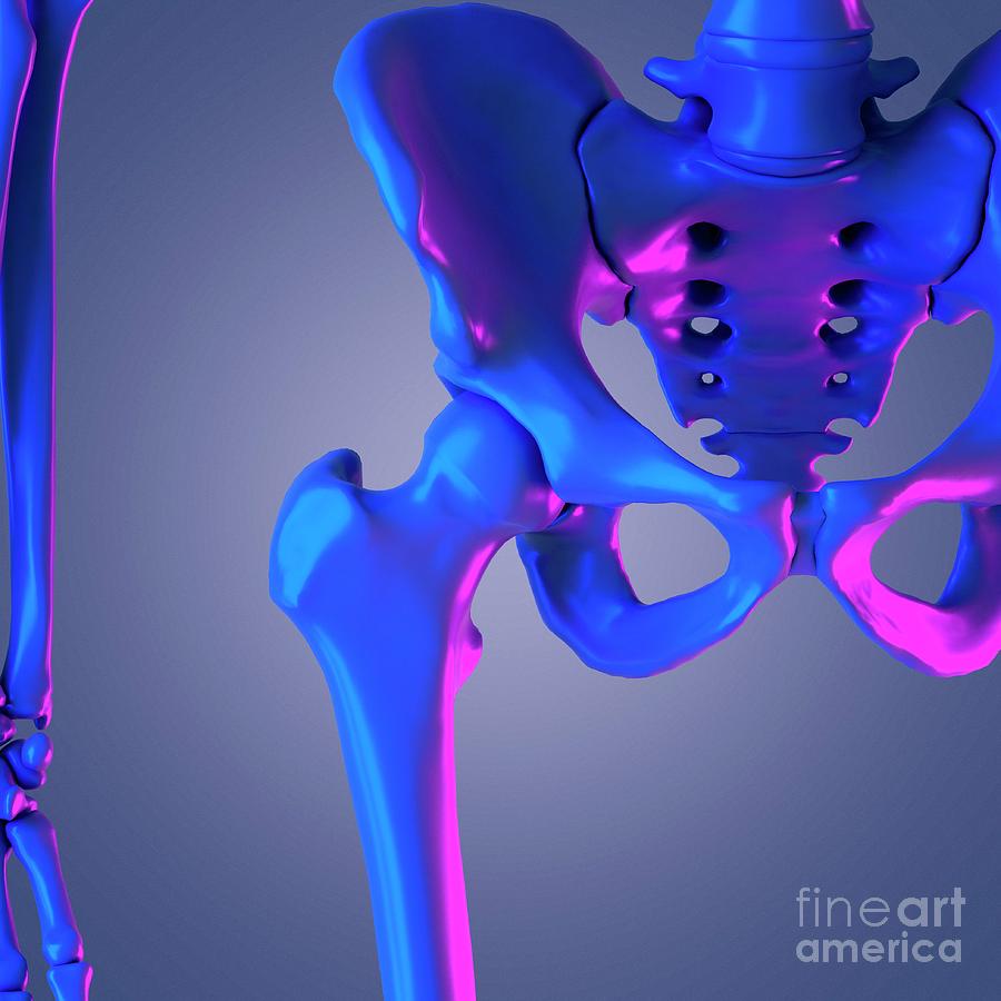 Hip Joint By Sebastian Kaulitzki Science Photo Library