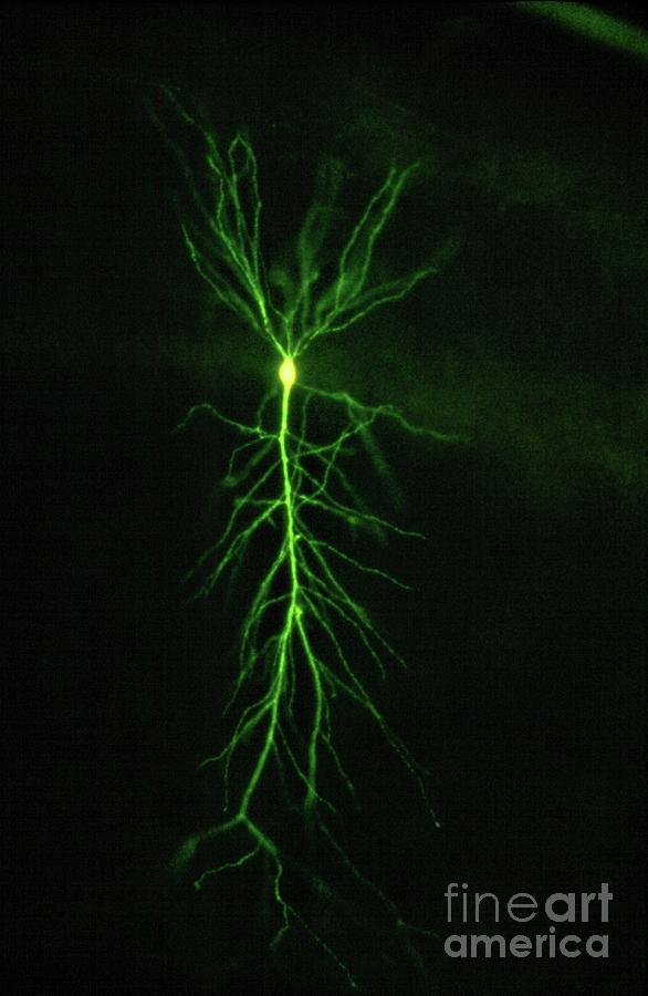 Hippocampus Pyramidal Neuron Photograph by Dennis Kunkel Microscopy/science Photo Library