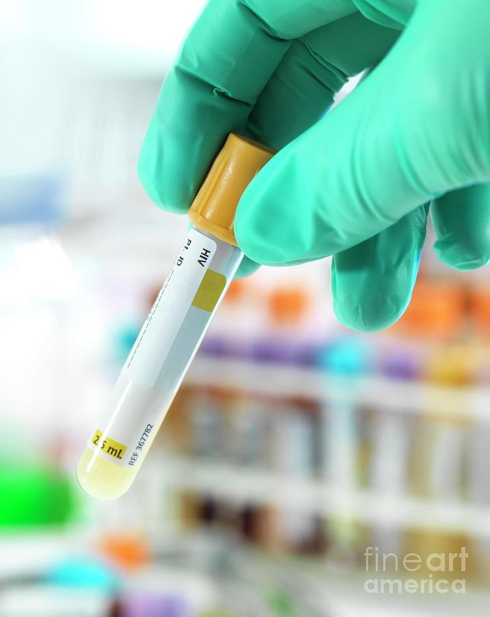 Hiv Photograph - Hiv Test by Tek Image/science Photo Library Hiv Photograph - Hiv Test by Tek Image/science Photo Library