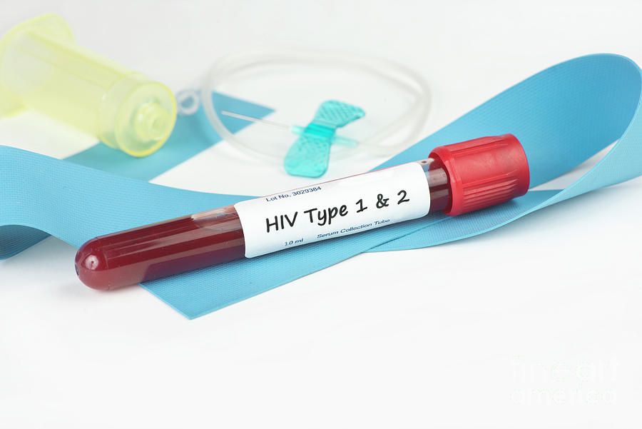 Hiv Type 1 And 2 Photograph by Sherry Yates Young/science Photo Library ...