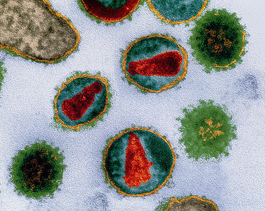 Hiv Viruses Photograph by Meckes/ottawa