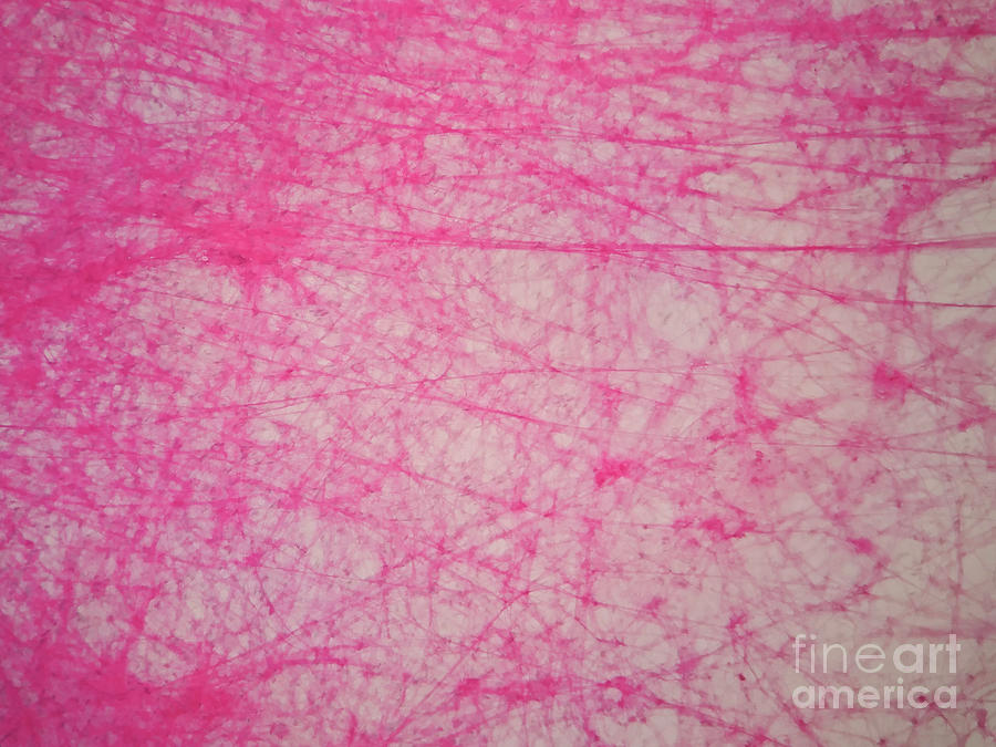 Human Areolar Tissue Photograph by Choksawatdikorn / Science Photo Library