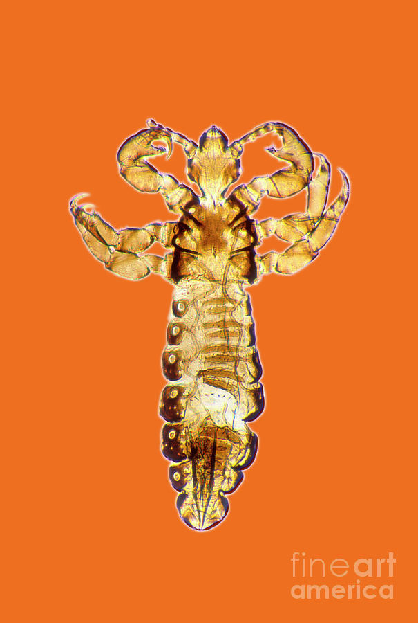 Human Body Louse Photograph by Dr Keith Wheeler/science Photo Library