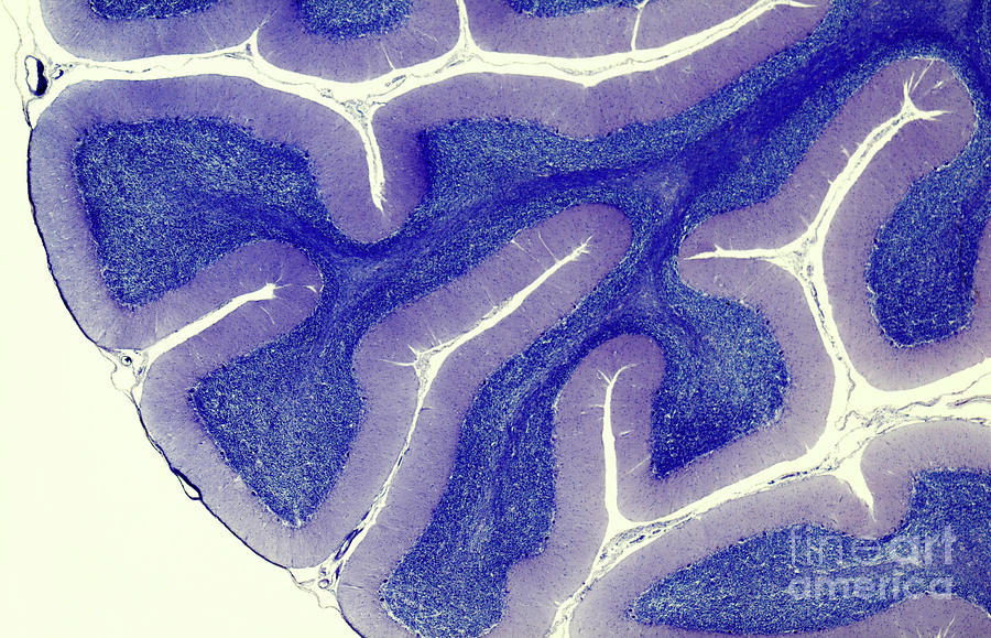 Human Brain Cerebellum Photograph by Nigel Downer/science Photo Library