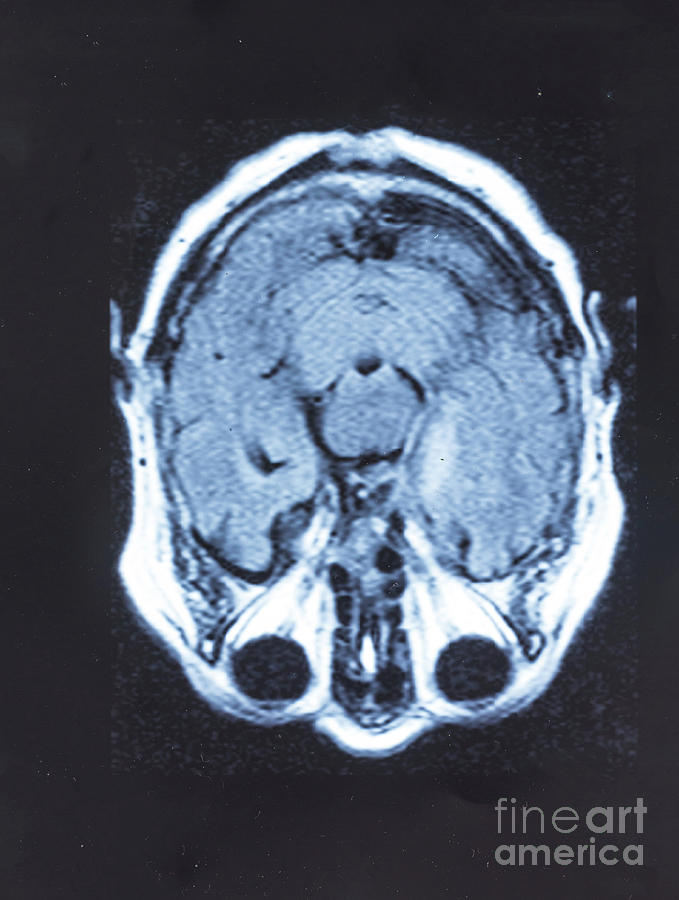 Medical Image Photograph - Human Brain by Wladimir Bulgar/science Photo Library Medical Image Photograph - Human Brain by Wladimir Bulgar/science Photo Library