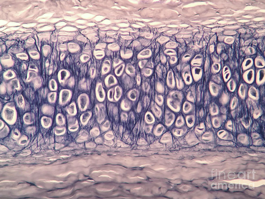 Human Cartilage Photograph by Choksawatdikorn / Science Photo Library ... Biology Diagrams