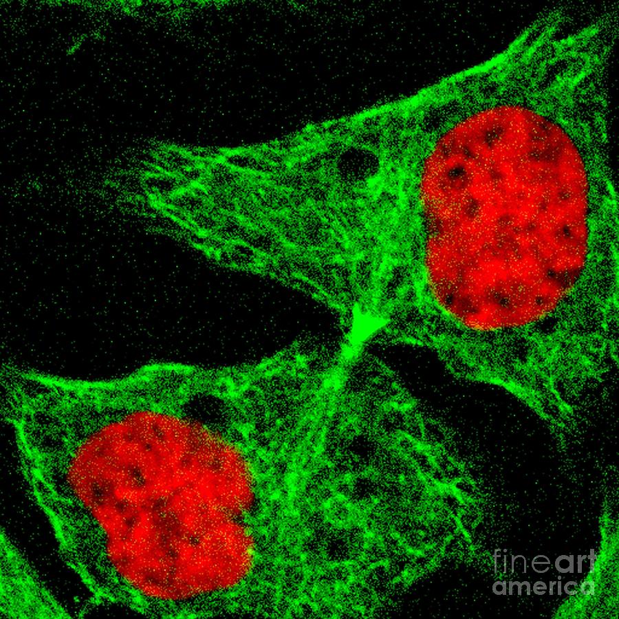 Human Cell Early In Cytokinesis Photograph by Dr Matthew Daniels/science Photo Library