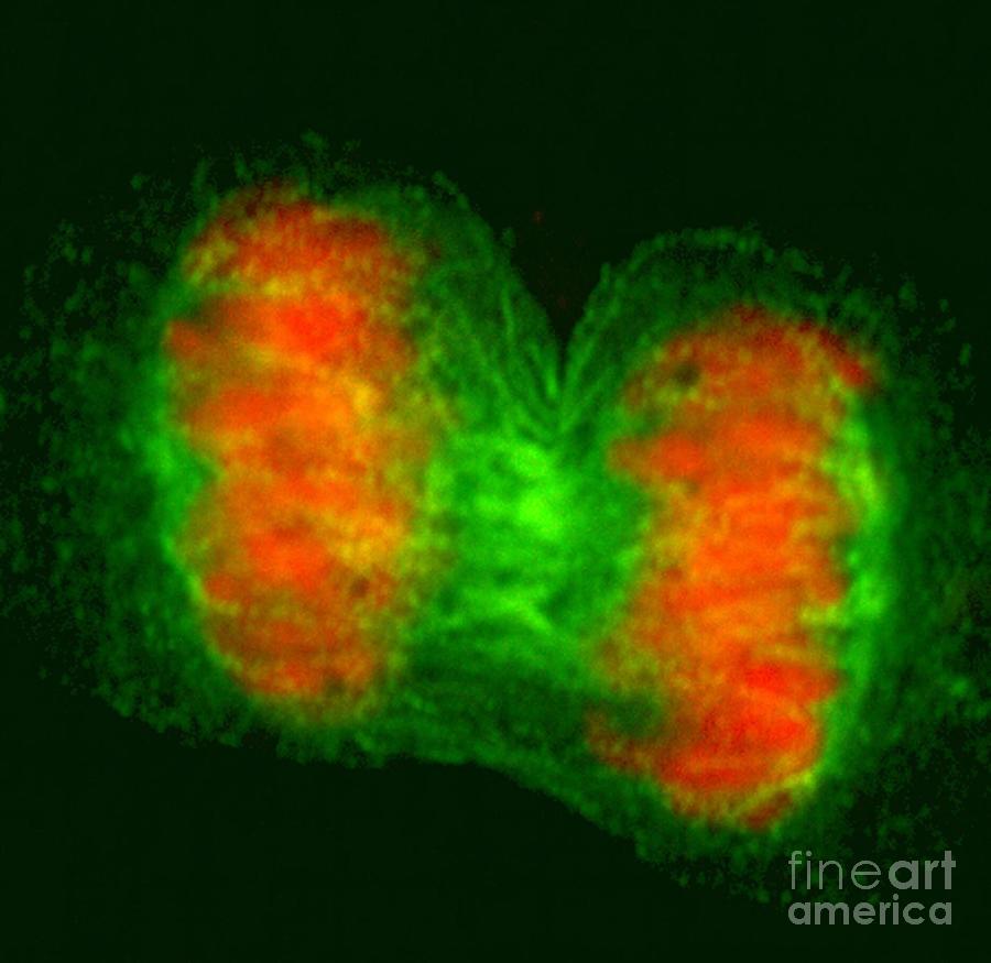 Human Cell In Anaphase Photograph by Dr Matthew Daniels/science Photo Library