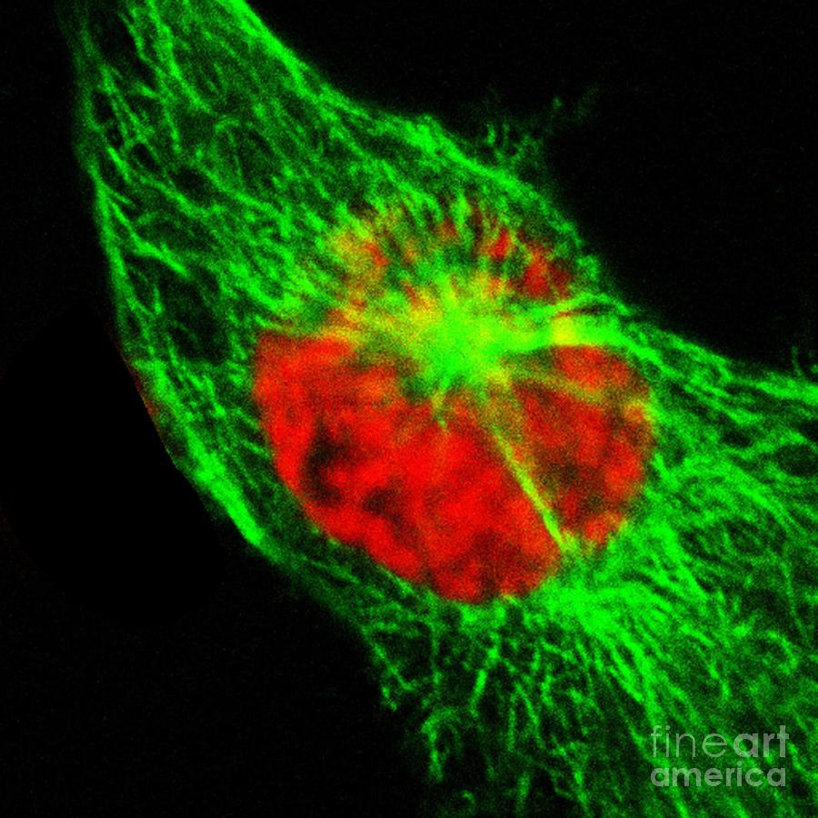 Human Cell In Early Prophase Photograph by Dr Matthew Daniels/science Photo Library