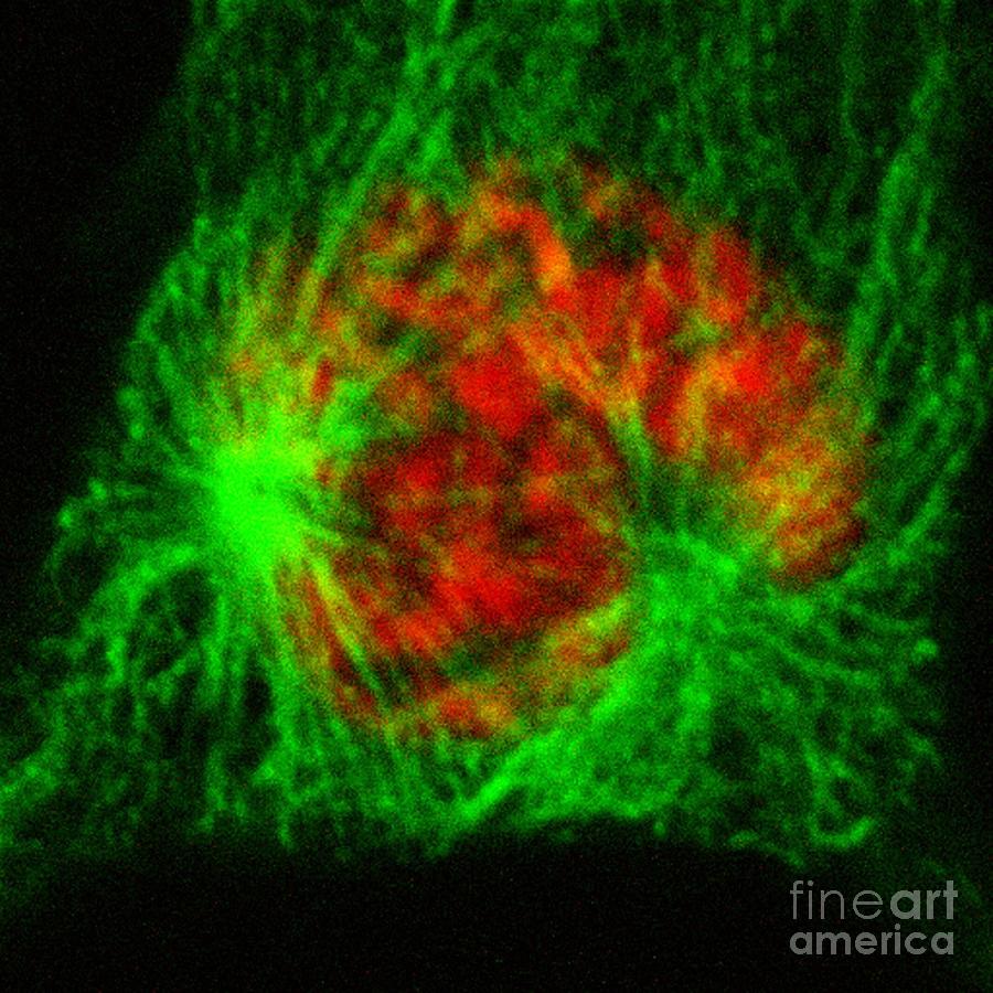 Human Cell In Late Prophase Photograph by Dr Matthew Daniels/science Photo Library