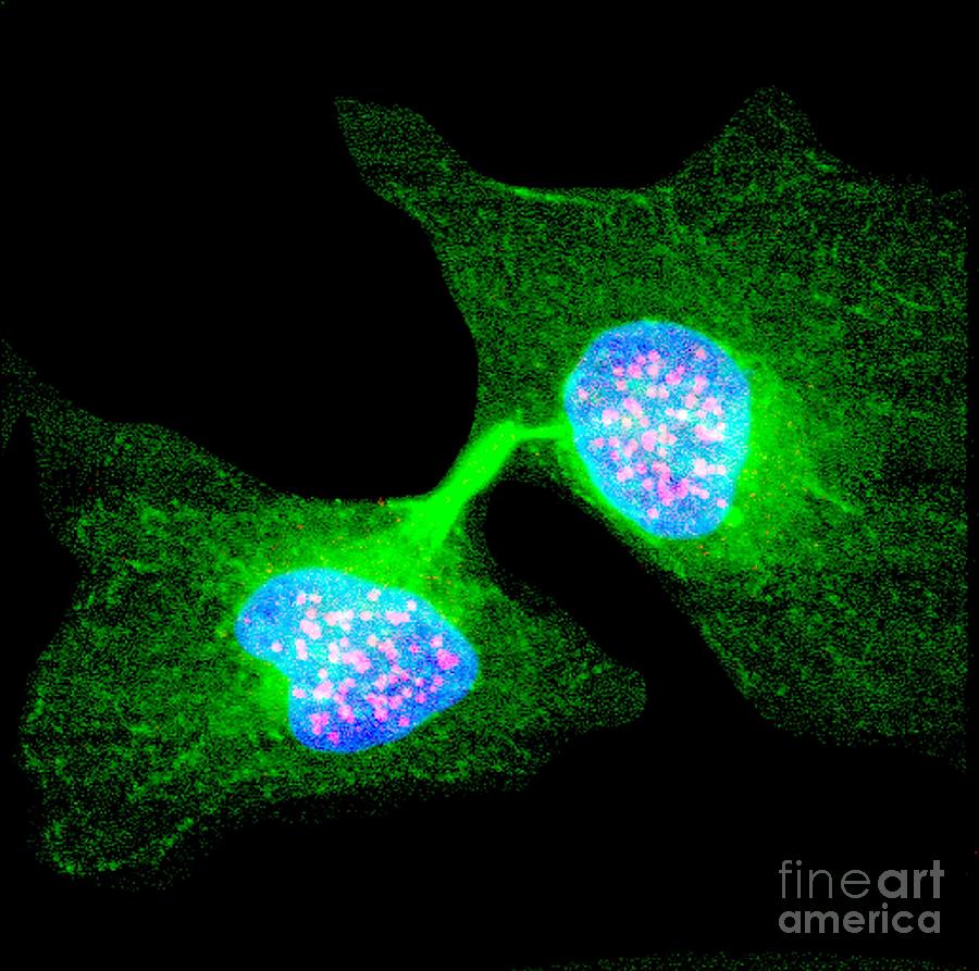 Human Cell In Telophase Photograph by Dr Matthew Daniels/science Photo ...