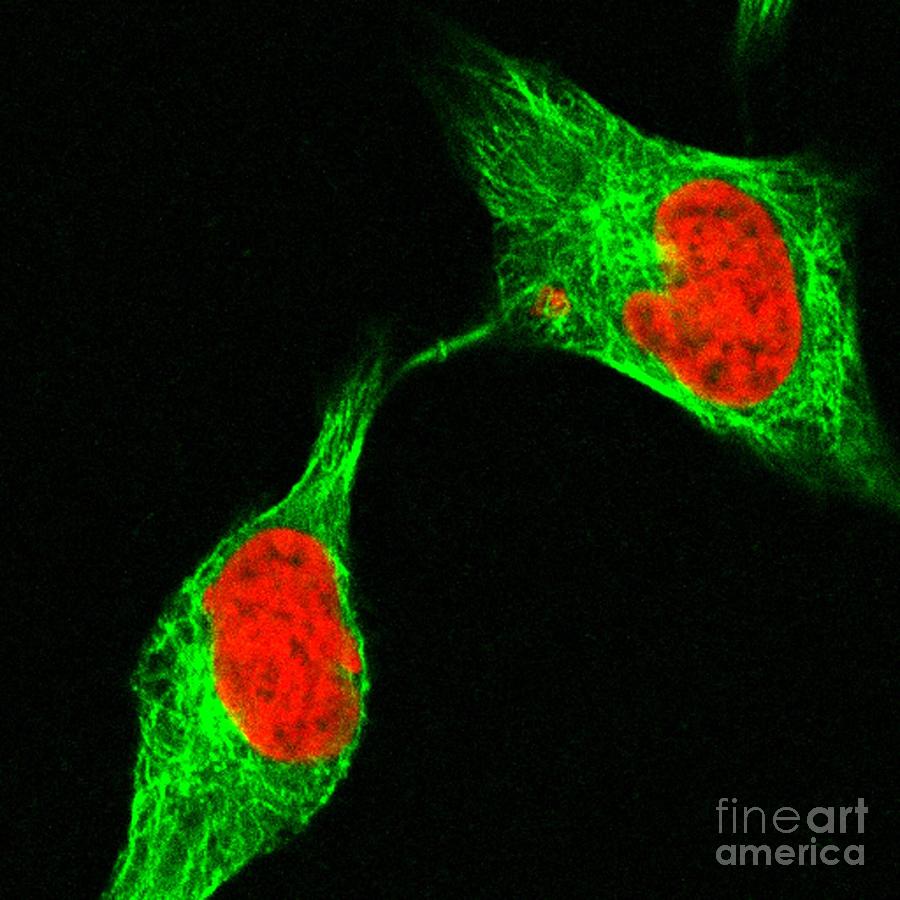 Human Cell Late In Cytokinesis Photograph by Dr Matthew Daniels/science Photo Library