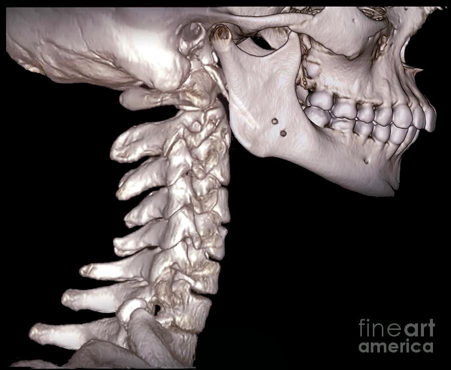 human cervical vertebrae