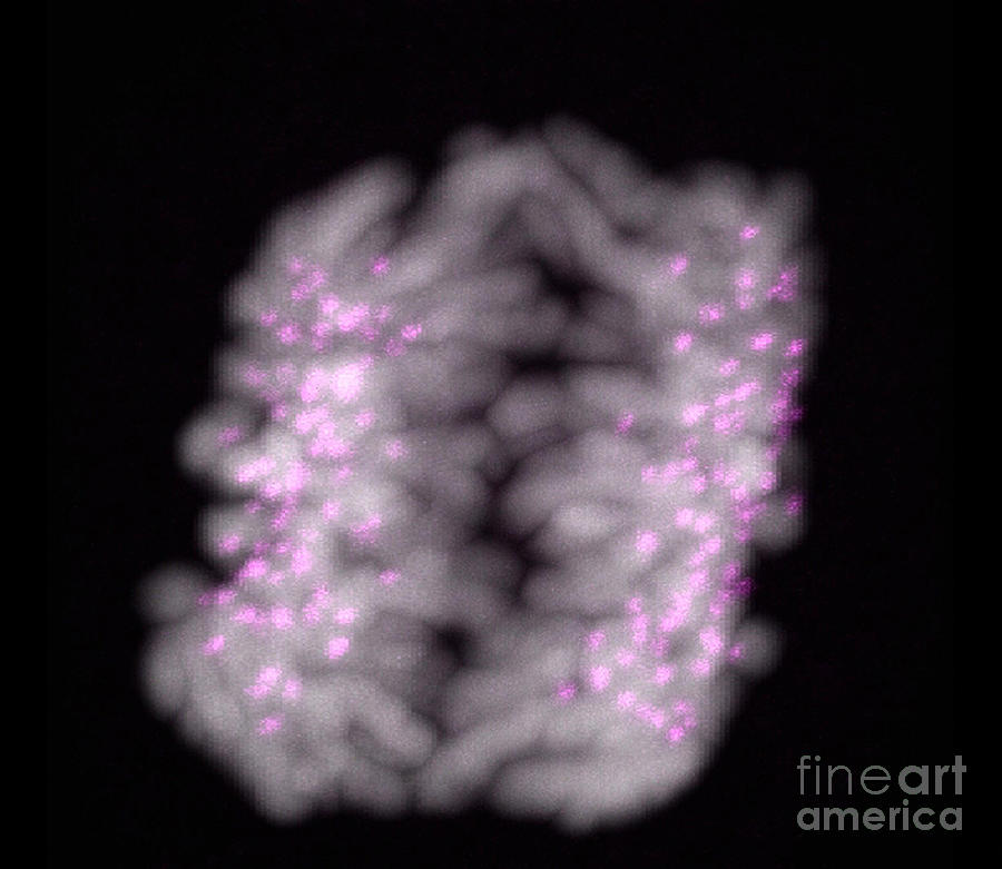 Human Chromosomes In Early Anaphase Photograph by Dr Matthew Daniels/science Photo Library