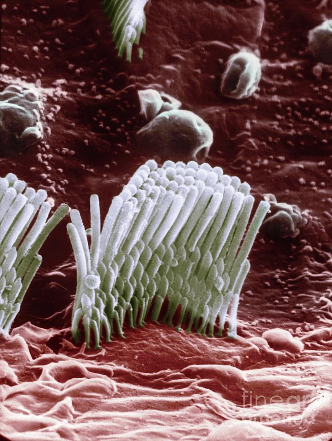 Human Ear Hair Cell Photograph by Professor Tony Wright, Institute Of Laryngology & Otology/science Photo Library