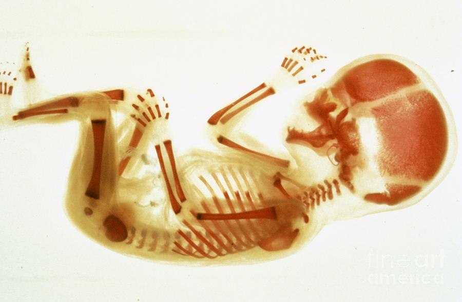 Human Embryo Photograph by Carolina Biological Supply Company/science Photo Library