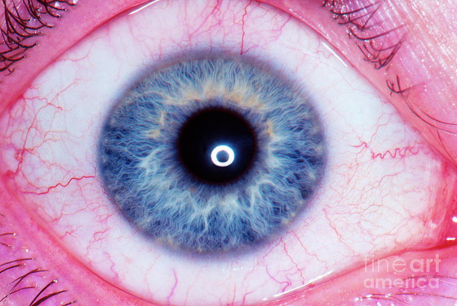 Human Eye Photograph by Dr M.a. Ansary/science Photo Library