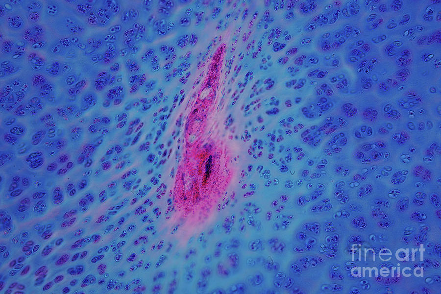 Human Hyaline Cartilage Photograph by Choksawatdikorn / Science Photo