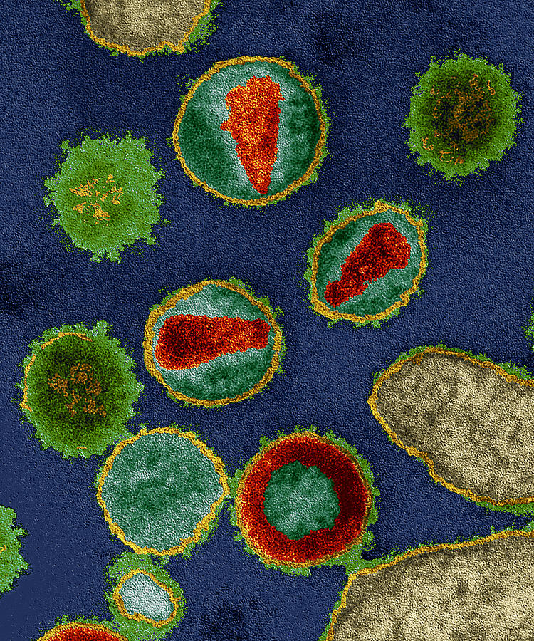 Human Immunodeficiency Virus Hiv Photograph by Oliver Meckes EYE OF SCIENCE