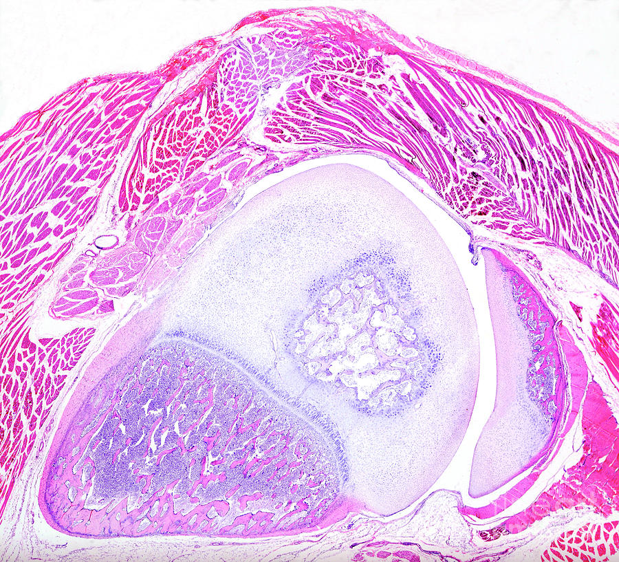 Human Joint Photograph by Nigel Downer/science Photo Library Biology Diagrams