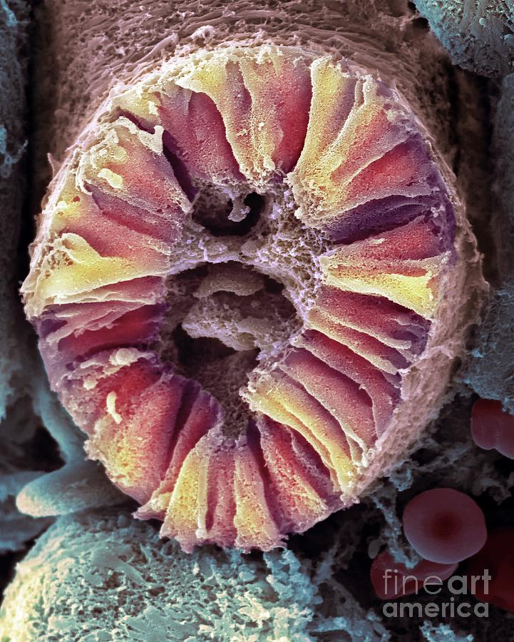 Human Kidney Nephron Photograph by Dennis Kunkel Microscopy/science Photo Library