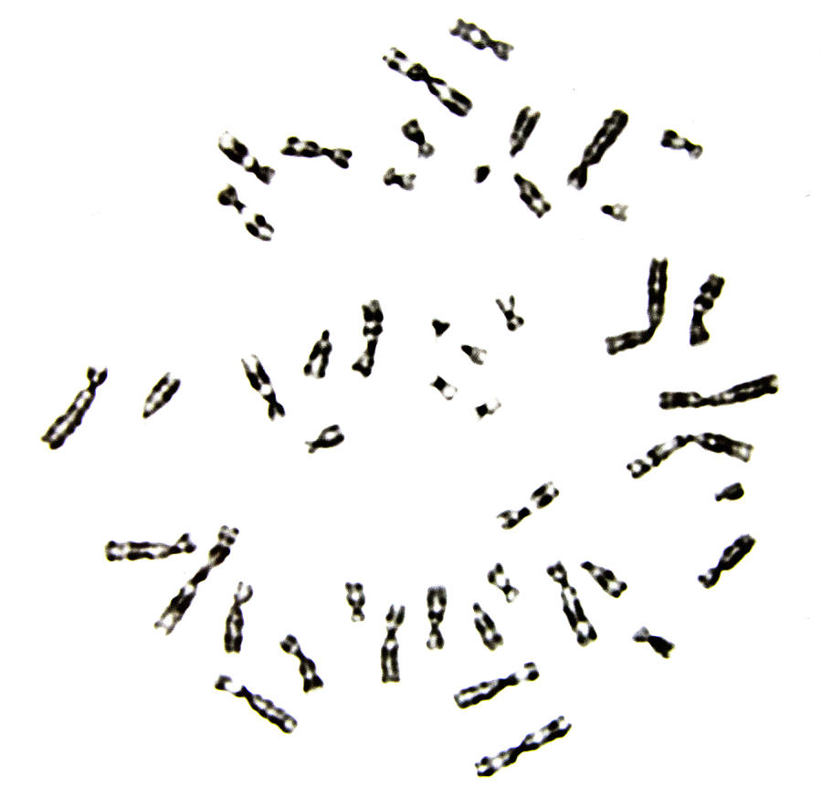 Human Metaphase Plate, Male, G-banding Photograph by Richard J. Green ...