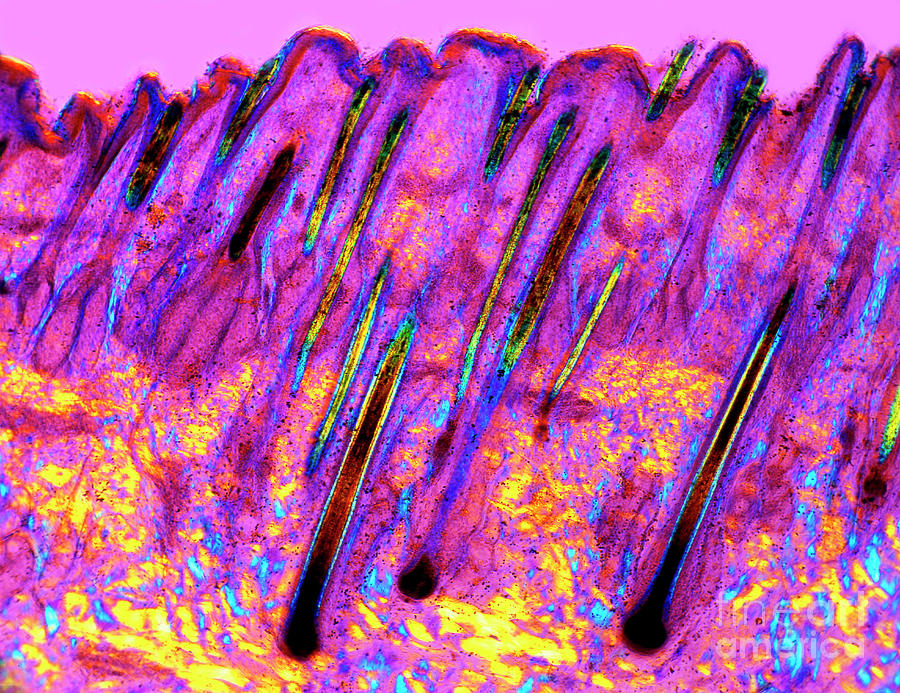 Human Skin Photograph by Dr Keith Wheeler/science Photo Library