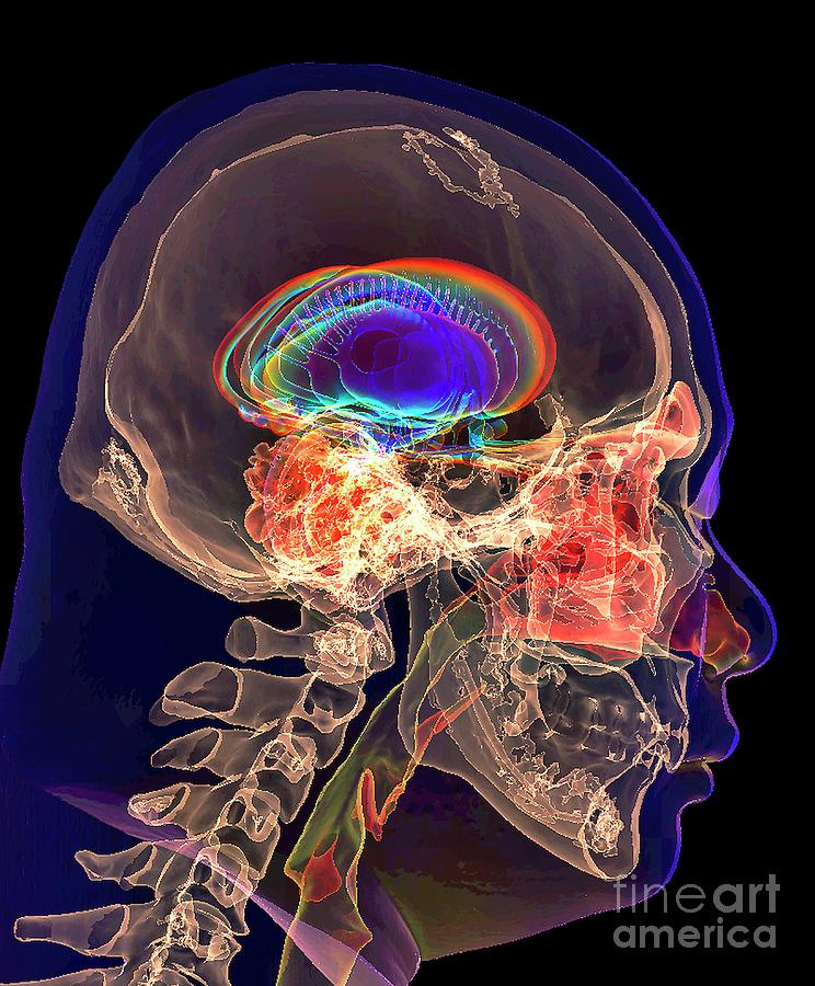 Human Skull And Limbic System Photograph by K H Fung/science Photo Library