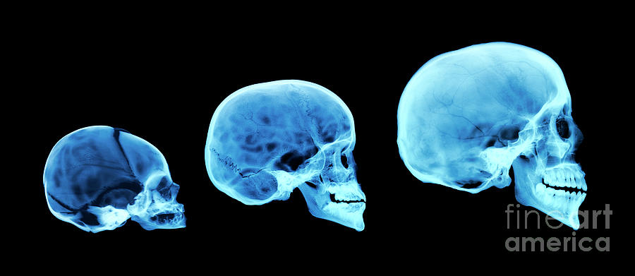 Human Skull Development Photograph by D. Roberts/science Photo Library