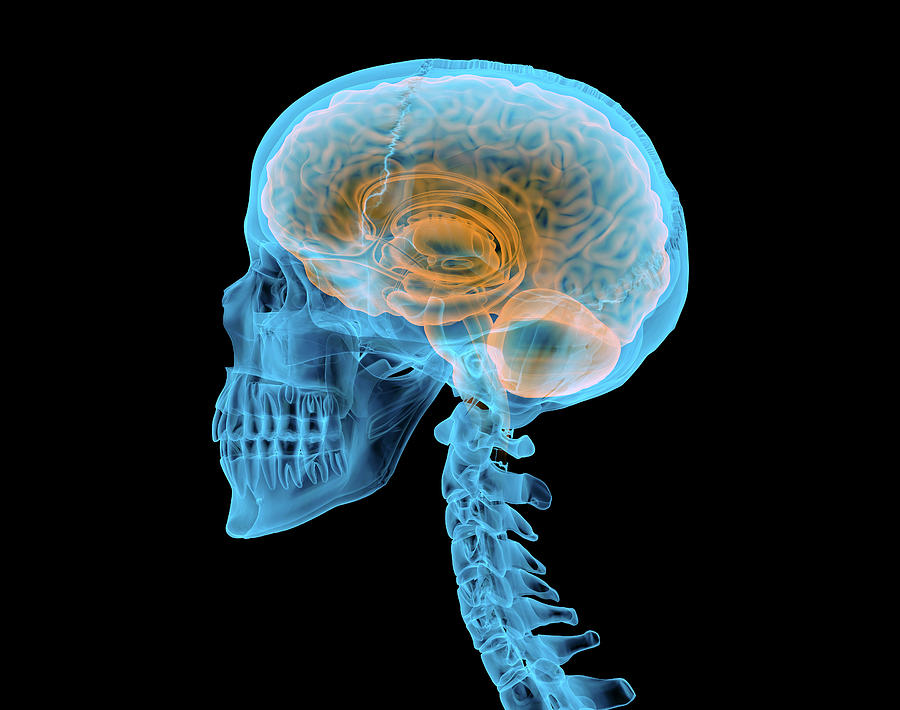 Human Skull With Brain, X-ray Effect Photograph by Leonello Calvetti