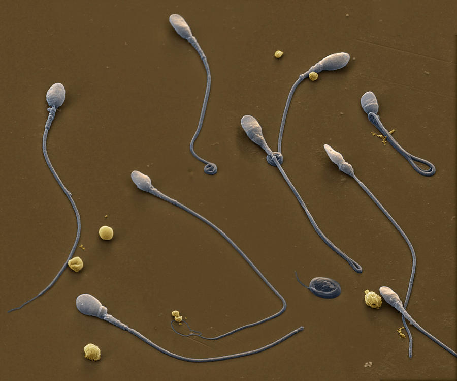 Human Sperm Cells Photograph by Meckes/ottawa