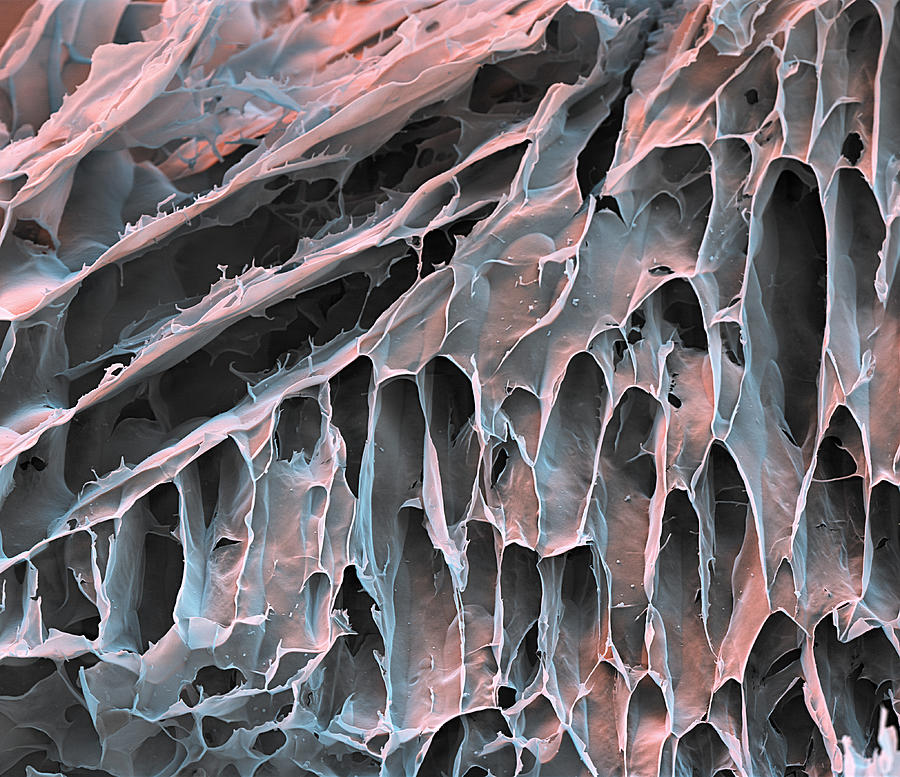 Hydrogel Of Synthetic Spider Silk, Sem Photograph by Meckes/ottawa