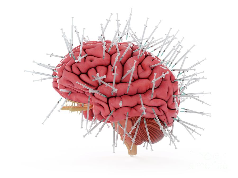 Illustration Of A Brain And Syringes Photograph by Sebastian Kaulitzki/science Photo Library