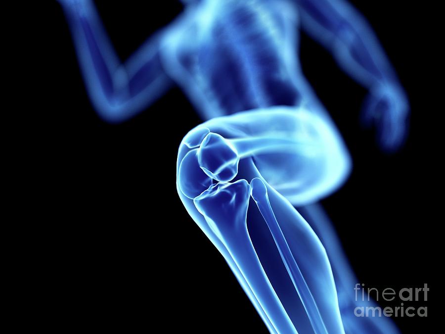 Illustration Of A Joggers Knee Photograph by Sebastian Kaulitzki/science Photo Library
