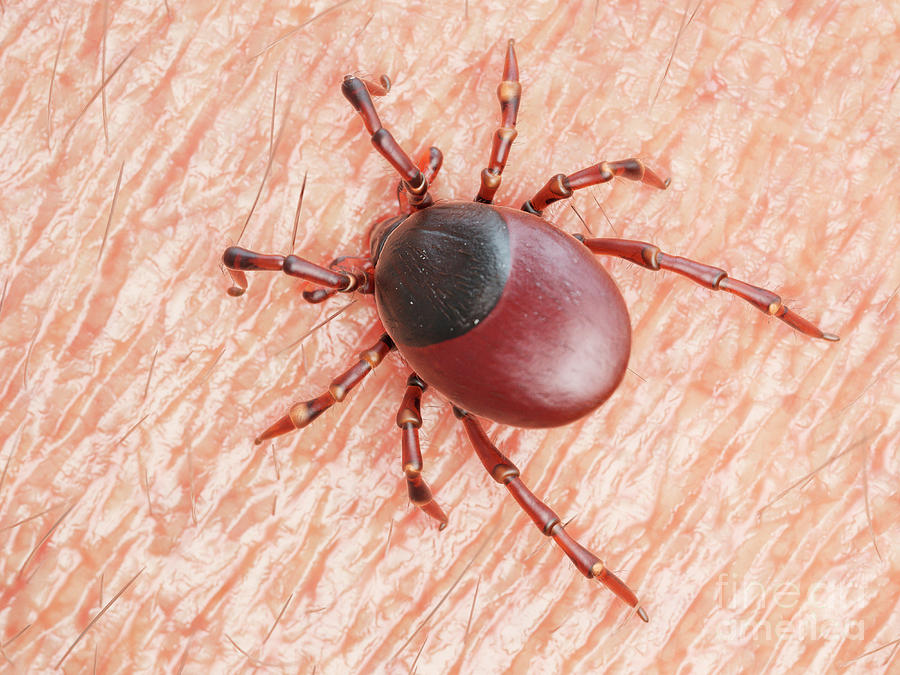 Illustration Of A Tick Biting Human Skin Photograph by Sebastian ...