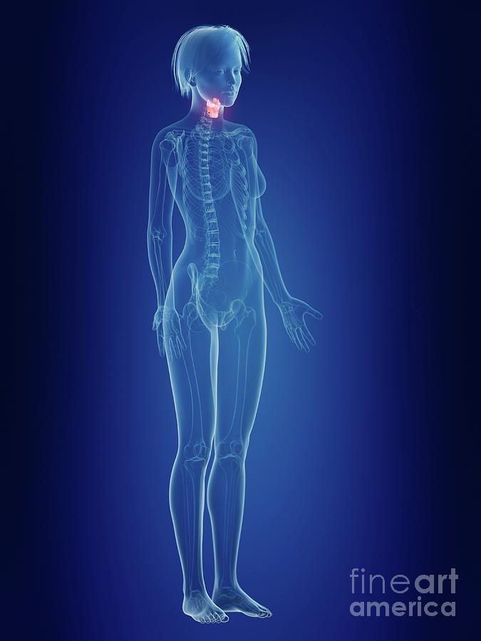 3d Photograph - Illustration Of A Womans Painful Larynx by Sebastian Kaulitzki/science Photo Library