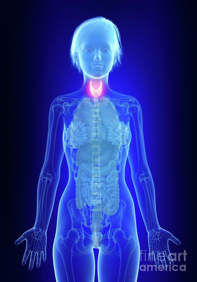 Illustration Of An Inflamed Thyroid Gland Photograph By Sebastian 1696