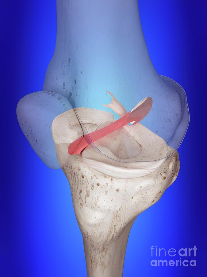 Illustration Of The Anterior Cruciate Ligament Photograph by Sebastian Kaulitzki/science Photo Library