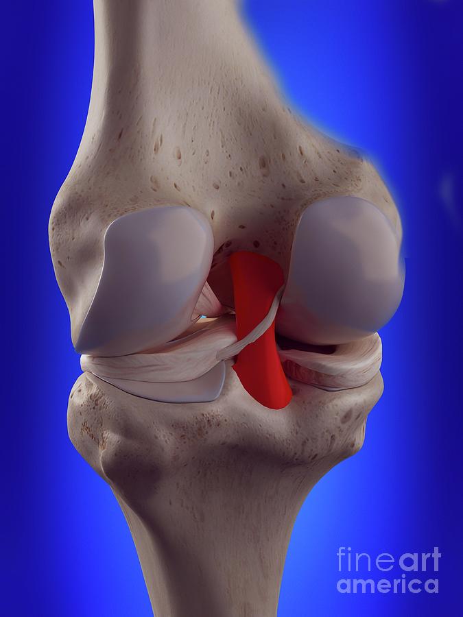 Illustration Of The Posterior Cruciate Ligament Photograph by Sebastian Kaulitzki/science Photo Library
