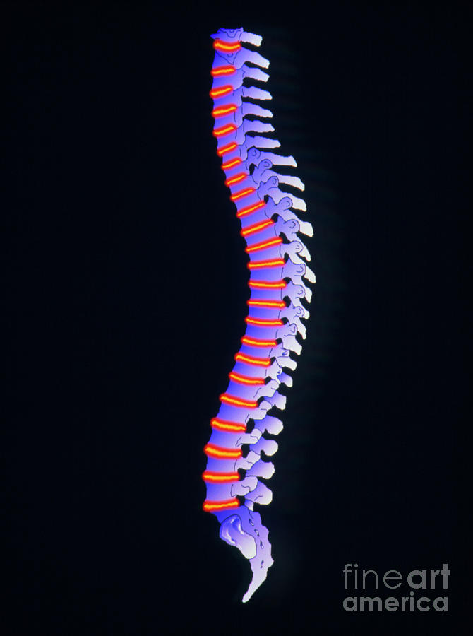 Illustration Of The Spine Photograph by Alfred Pasieka/science Photo Library