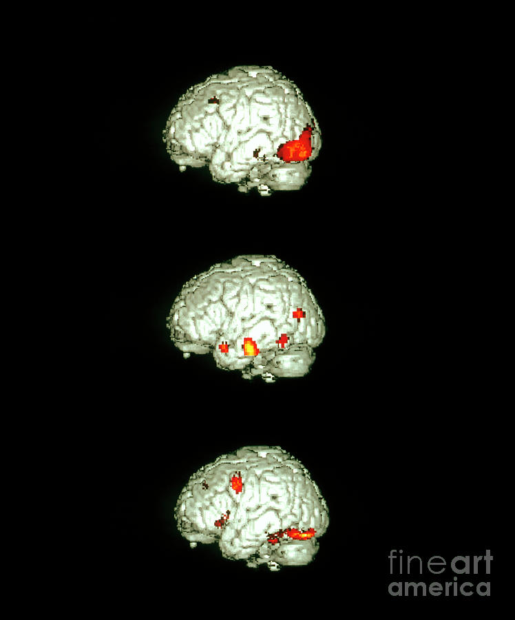 Image-processing Brain Activity Photograph by Wellcome Centre Human Neuroimaging/science Photo Library