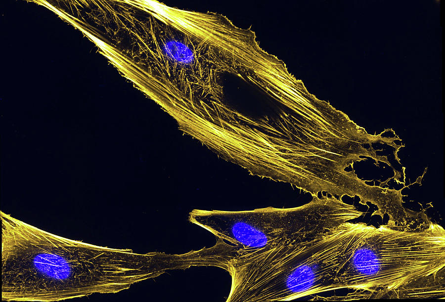 Immunofluorescence Image Of Actin Photograph by National Institutes of Health