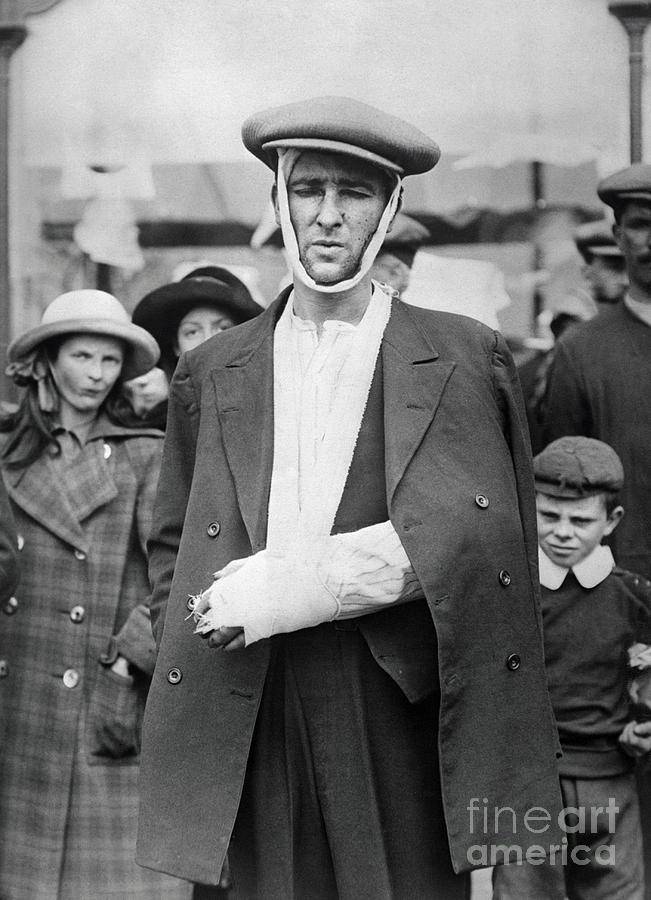 Injured Crew Member Of The Lusitania Photograph by Bettmann