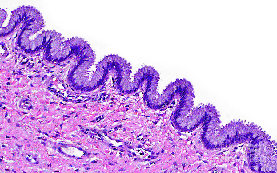 Inner Cervix Glands Photograph by Ziad M. El-zaatari/science Photo ...