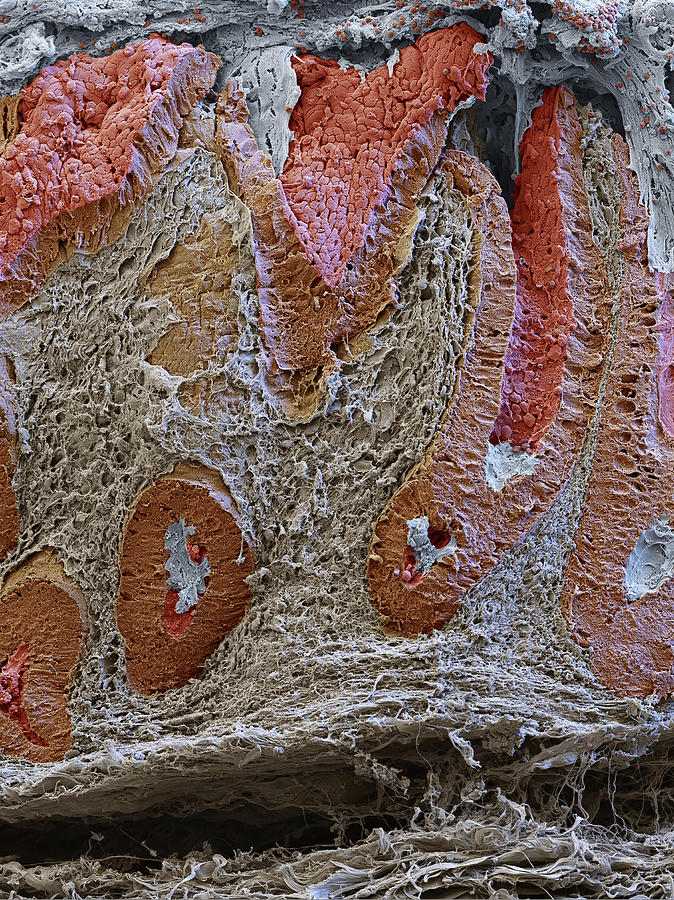 Intestinal Mucosa, Sem Photograph by Eye Of Science